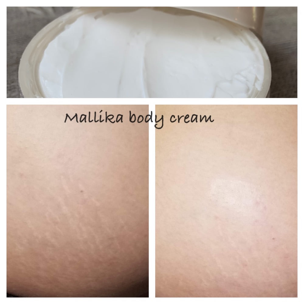 STRETCH MARK Body creamX2 100 ml